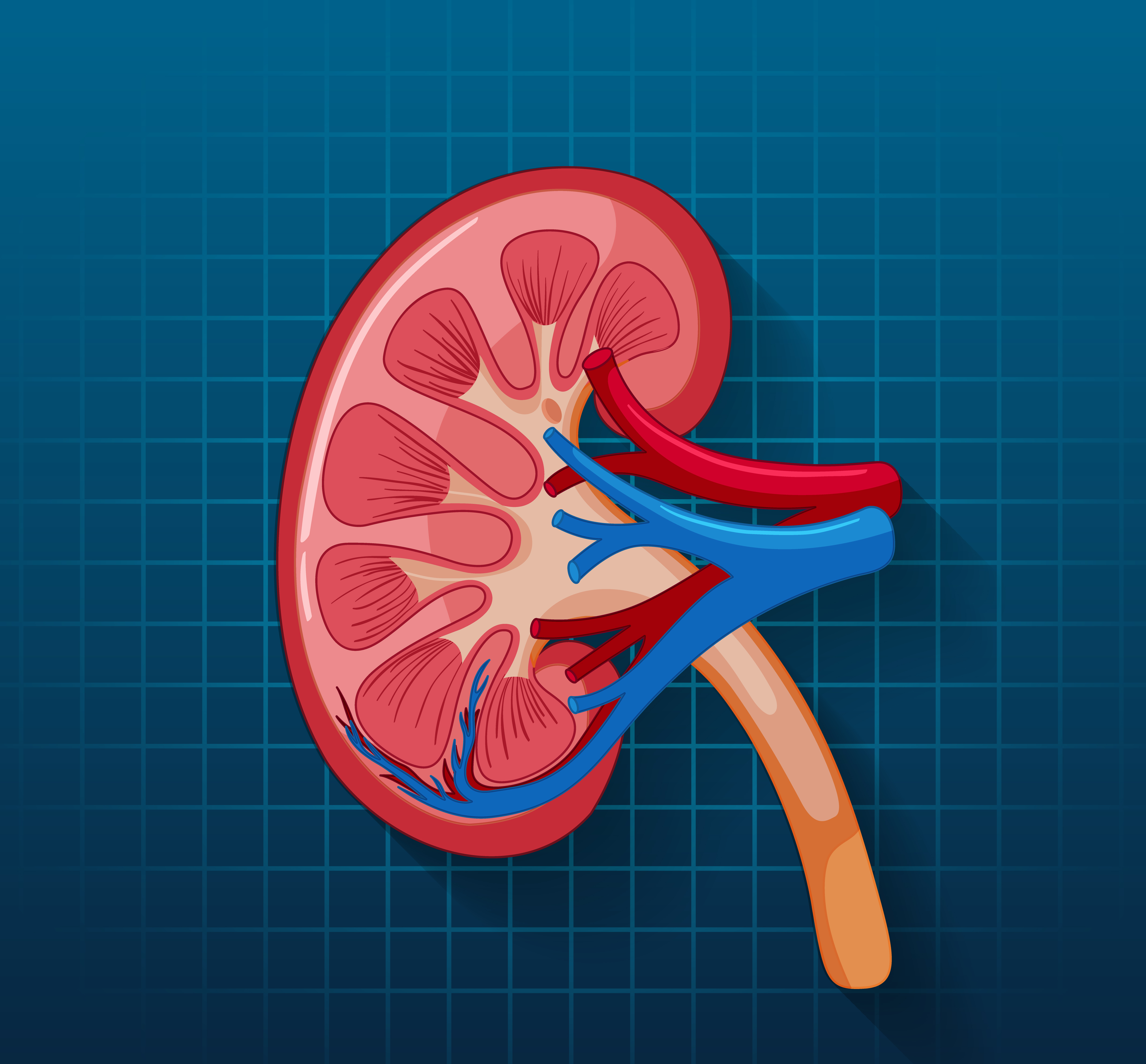 Renal Transplant